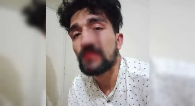 Hombre denuncia la agresión homofóbica en su contra en un bar de Bogotá