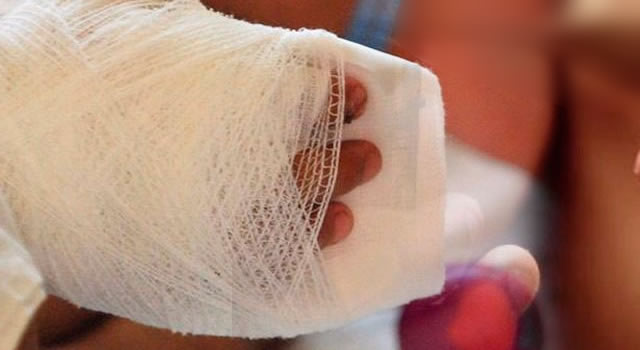 Van 10 quemados con pólvora en Cundinamarca