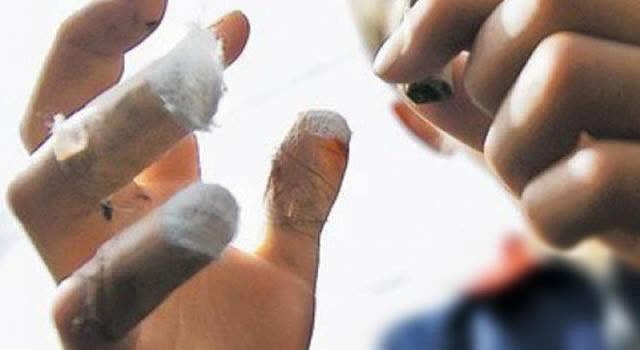 En diciembre van 16 quemados con pólvora en Cundinamarca
