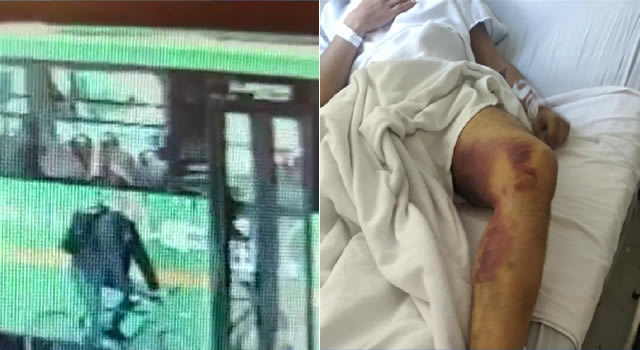 Conductor de Sitp atropelló a ciclista y se dio a la fuga, a la víctima le han hecho dos cirugías