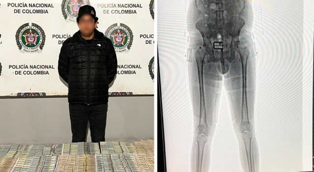 Capturan en el aeropuerto un hombre con más de 60 mil dólares en su ropa interior