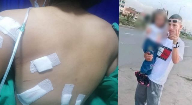 Intento de feminicidio en el municipio de Soacha