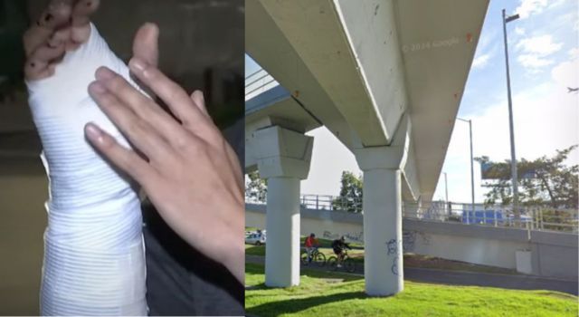 Hirieron a un joven en El Dorado por robarlo